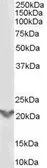 Anti-TGF beta induced factor 2 antibody, Internal used in Western Blot (WB). GTX89501