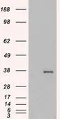 Anti-GDF15 antibody, C-term used in Western Blot (WB). GTX89503