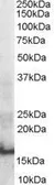 Anti-SH2D1A antibody, Internal used in Western Blot (WB). GTX89516