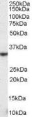 Anti-NKG2D antibody, Internal used in Western Blot (WB). GTX89520