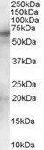 Anti-Syk antibody, Internal used in Western Blot (WB). GTX89525