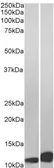 Anti-MIF antibody, C-term used in Western Blot (WB). GTX89535