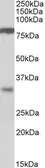 Anti-CLCA1 antibody, Internal used in Western Blot (WB). GTX89537