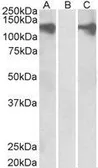 Anti-Pumilio 2 antibody, Internal used in Western Blot (WB). GTX89543
