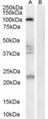 Anti-Nogo Receptor antibody, Internal used in Western Blot (WB). GTX89548