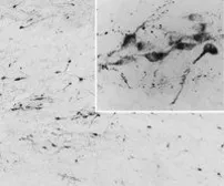 Anti-AGRP antibody, C-term used in IHC (Frozen sections) (IHC-Fr). GTX89559