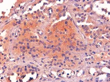 Anti-POMC antibody used in IHC (Paraffin sections) (IHC-P). GTX89560