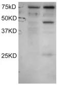 Anti-DYX1C1 (Isoform a) antibody, C-term used in Western Blot (WB). GTX89566