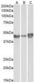Anti-PAI-1 antibody, Internal used in Western Blot (WB). GTX89568