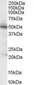 Anti-PDHX antibody, C-term used in Western Blot (WB). GTX89576