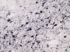 Anti-Tyrosine Hydroxylase antibody, C-term used in IHC (Frozen sections) (IHC-Fr). GTX89578