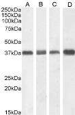 Anti-Nucleophosmin antibody, C-term used in Western Blot (WB). GTX89581