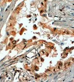 Anti-SRD5A1 antibody, N-term used in IHC (Paraffin sections) (IHC-P). GTX89584