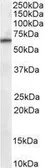 Anti-PPP2R1A antibody, C-term used in Western Blot (WB). GTX89587