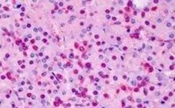 Anti-Triosephosphate isomerase antibody, C-term used in IHC (Paraffin sections) (IHC-P). GTX89594