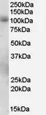 Anti-PDE5A antibody, C-term used in Western Blot (WB). GTX89598