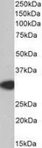 Anti-MyD88 antibody, Internal used in Western Blot (WB). GTX89605