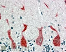 Anti-Retinoic Acid Receptor alpha antibody, C-term used in IHC (Paraffin sections) (IHC-P). GTX89607