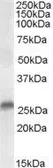 Anti-SRD5A2 antibody, N-term used in Western Blot (WB). GTX89611