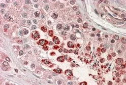 Anti-XAGE1 (Isoform 1d) / GAGED2 antibody, C-term used in IHC (Paraffin sections) (IHC-P). GTX89612