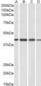 Anti-Centaurin alpha 1 antibody, C-term used in Western Blot (WB). GTX89614