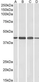 Anti-Centaurin alpha 1 antibody, C-term used in Western Blot (WB). GTX89614