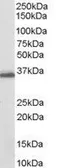 Anti-AKR1C3 antibody, C-term used in Western Blot (WB). GTX89620