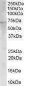 Anti-Choline Acetyltransferase antibody, C-term used in Western Blot (WB). GTX89623