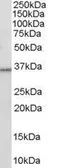 Anti-HSD11B1 antibody, C-term used in Western Blot (WB). GTX89627