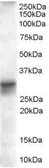 Anti-FHL1 isoform B antibody, Internal used in Western Blot (WB). GTX89636