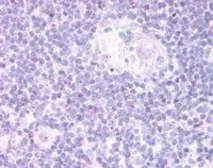 Anti-FOXN1 antibody, C-term used in IHC (Paraffin sections) (IHC-P). GTX89637