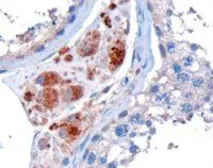 Anti-Clik1 / STK35 antibody, C-term used in IHC (Paraffin sections) (IHC-P). GTX89642