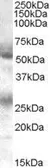 Anti-FLVCR antibody, C-term used in Western Blot (WB). GTX89644