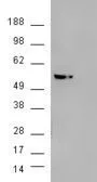 Anti-AKT3 antibody, Internal used in Western Blot (WB). GTX89647