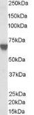 Anti-TOM1L2 antibody, C-term used in Western Blot (WB). GTX89650