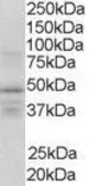Anti-Retinoid X Receptor gamma antibody, Internal used in Western Blot (WB). GTX89653