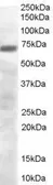 Anti-PRDM4 antibody, C-term used in Western Blot (WB). GTX89654