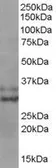 Anti-Livin antibody, C-term used in Western Blot (WB). GTX89665