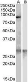 Anti-SCARF1 antibody, Internal used in Western Blot (WB). GTX89666