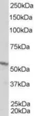 Anti-Retinoid X Receptor beta antibody, Internal used in Western Blot (WB). GTX89670