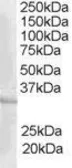 Anti-CREM antibody, C-term used in Western Blot (WB). GTX89673