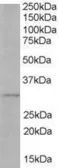 Anti-TIRAP / Mal (Isoform b) antibody, C-term used in Western Blot (WB). GTX89676