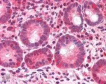Anti-BAZ2B antibody, C-term used in IHC (Paraffin sections) (IHC-P). GTX89680