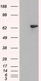 Anti-LNK antibody, N-term used in Western Blot (WB). GTX89686