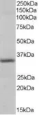 Anti-Pirin antibody, N-term used in Western Blot (WB). GTX89691