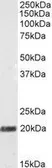 Anti-STMN2 antibody, N-term used in Western Blot (WB). GTX89696