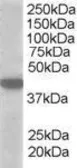 Anti-MCT2 antibody, C-term used in Western Blot (WB). GTX89697