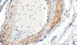 Anti-alpha Smooth Muscle Actin antibody, N-term used in IHC (Paraffin sections) (IHC-P). GTX89701