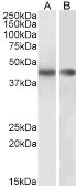 Anti-alpha Smooth Muscle Actin antibody, N-term used in Western Blot (WB). GTX89701