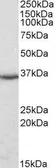 Anti-DDAH1 antibody, C-term used in Western Blot (WB). GTX89709